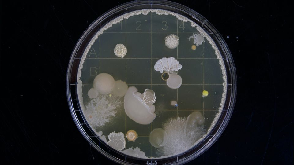 Staphylococcus aureus as a cause of refractory chronic rhinosinusitis