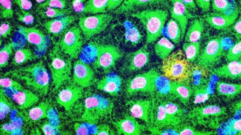 Stem cells under a microscope.