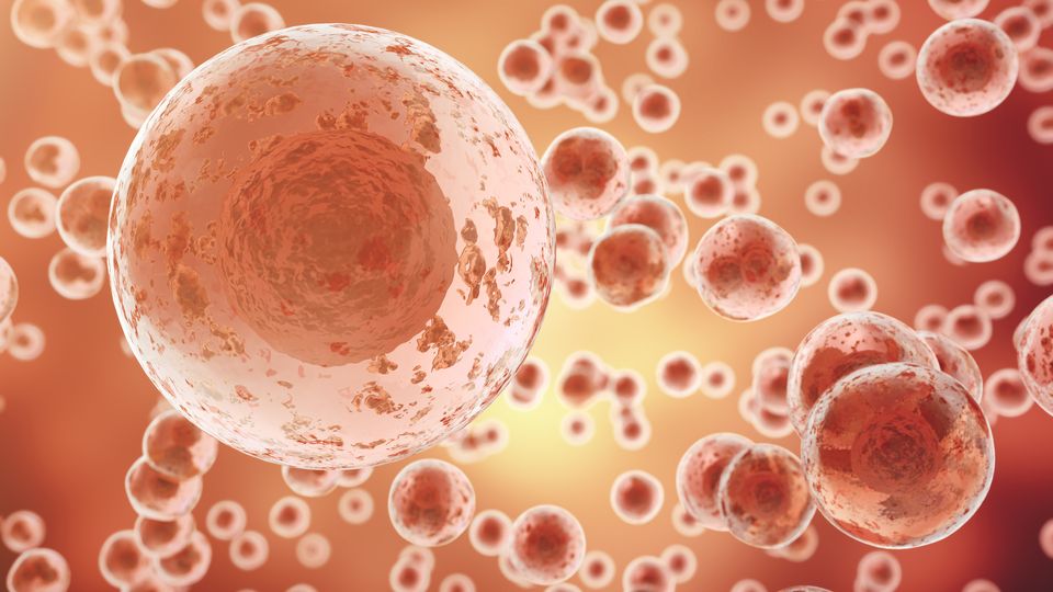 Cancer cells.