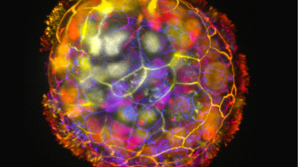An Anthrobot is shown, depth colored, with a corona of cilia that provides locomotion for the bot. Credit: Gizem Gumuskaya, Tufts University
