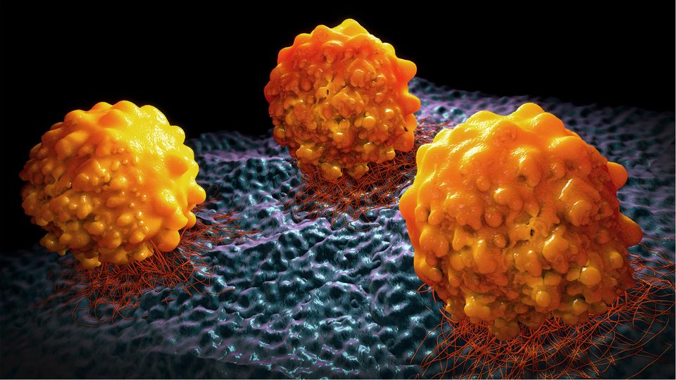 Three cancer cells adhered to a surface