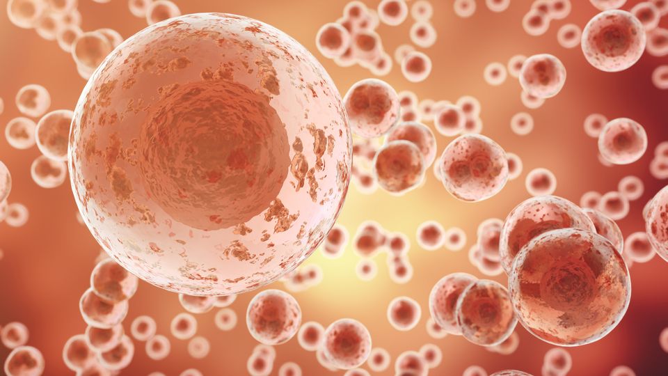 Cancer cells.