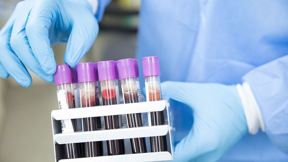 Vials of blood for testing, carried by a clinician.