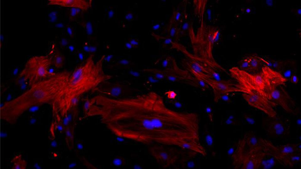 Fibroblasts under a microscope.