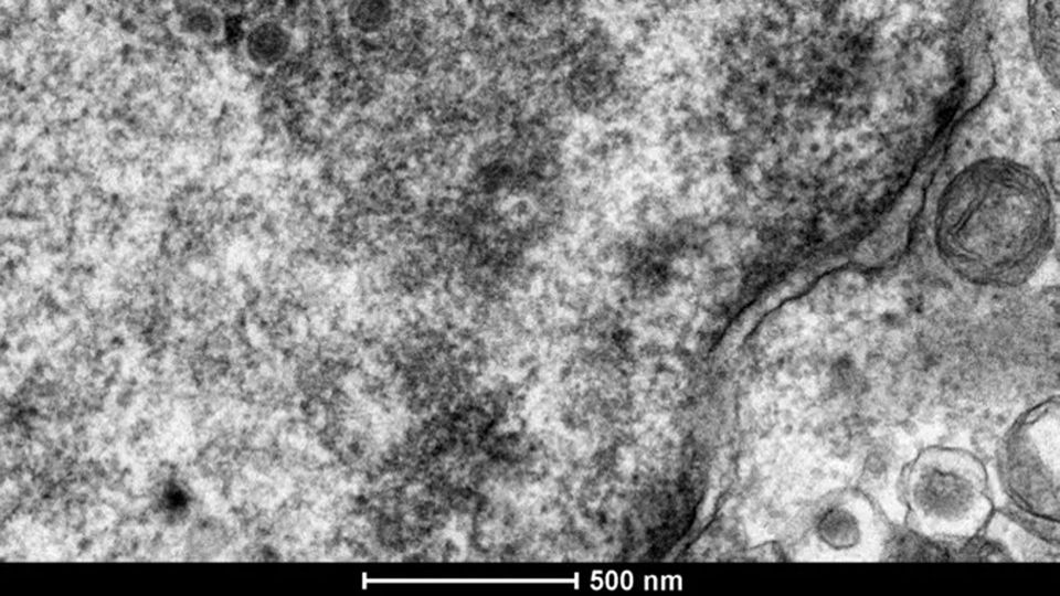Electron Microscopy image of Marek’s disease virus particles replicating in the nucleus of an infected cell.