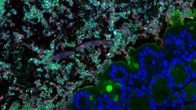 Diverse Gut Bacteria Communities Block Harmful Pathogens From Nutrients ...