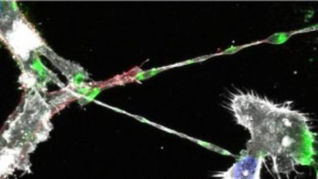 Ebola virus proteins (green) are detected in the long tunneling nanotubes connecting cells. 