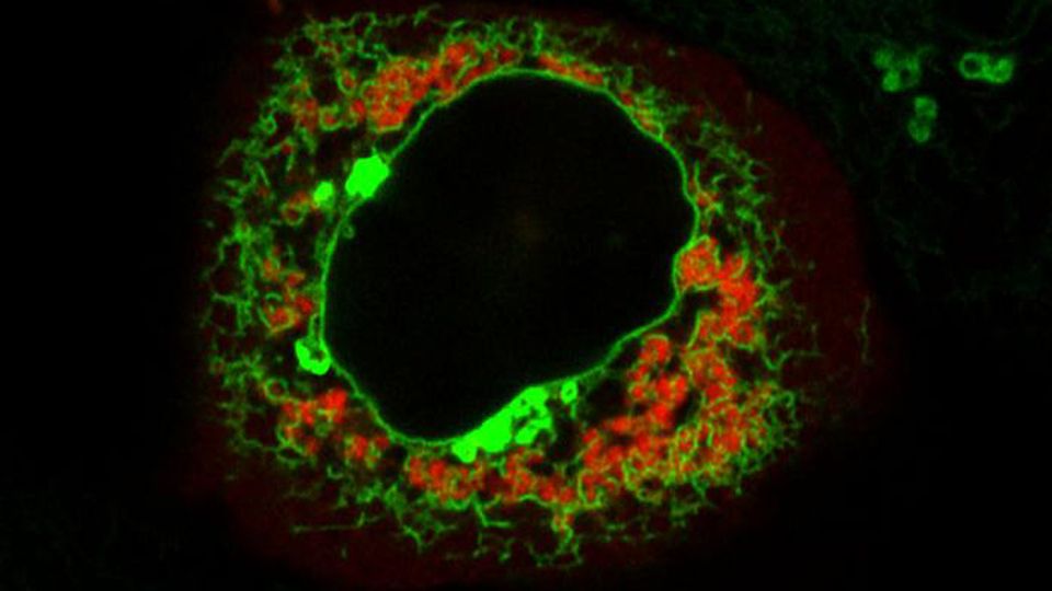 A cell under fluorescent microscopy.