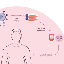 A diagram showing the steps of CAR T-cell therapy 