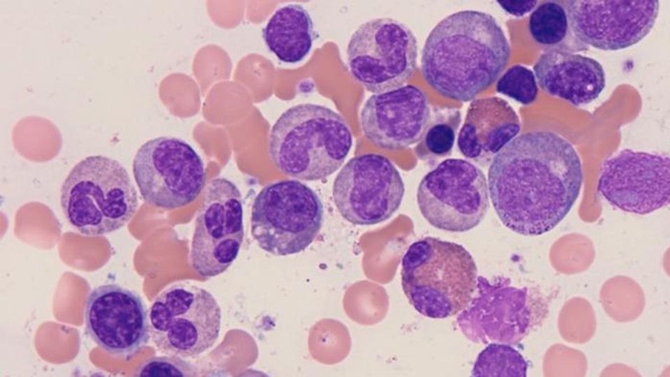 Neutrophils under a microscope.