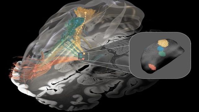 Floating Pinpoints Deep Brain Stimulation Pinpoints Disrupted Neural Pathways | Technology ...