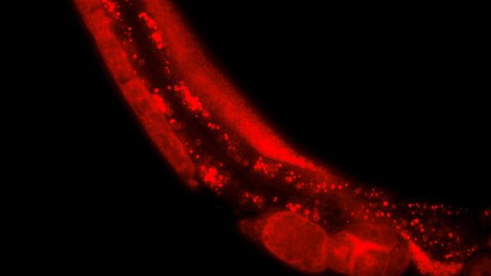 Microscopic fluorescence image of a C.tropicalis mother worm.