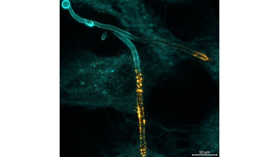 The path of the Candidalysis toxin is mapped in yellow.