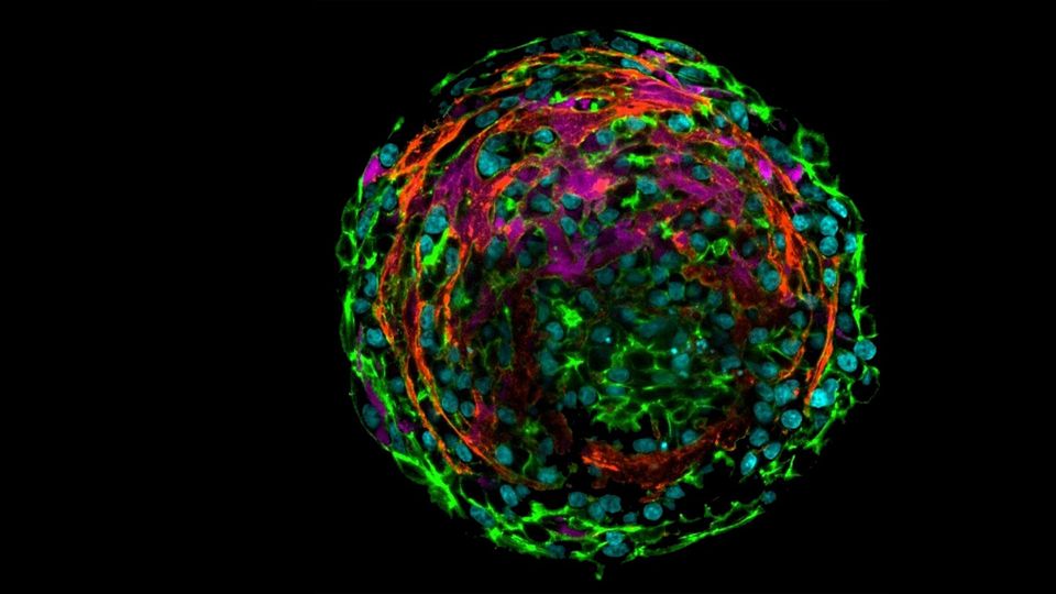Ocular Fibrosis, 3D Cell Culture Image, spherical microscopy image with various colors. 
