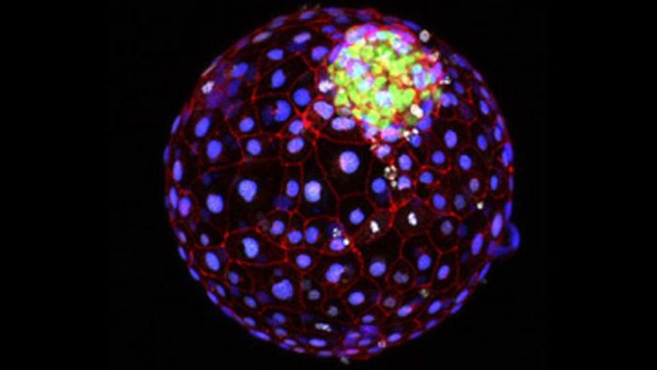A blastoid cell model system, with nuclei shown in blue.