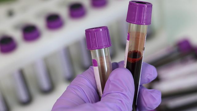 A scientist holding two tubes containing human blood samples 