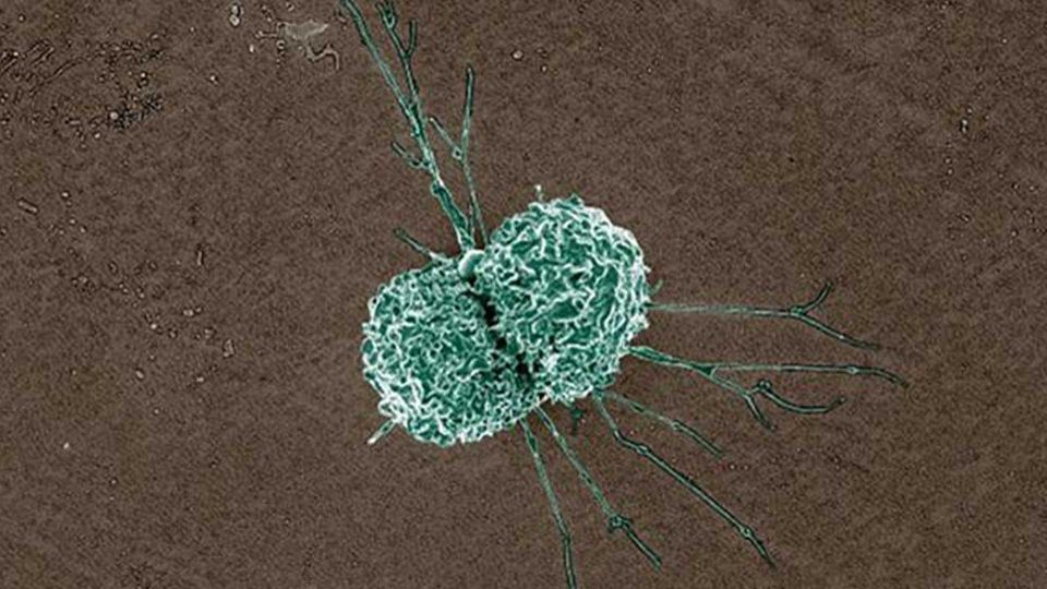 This micrograph shows a single macrophage.