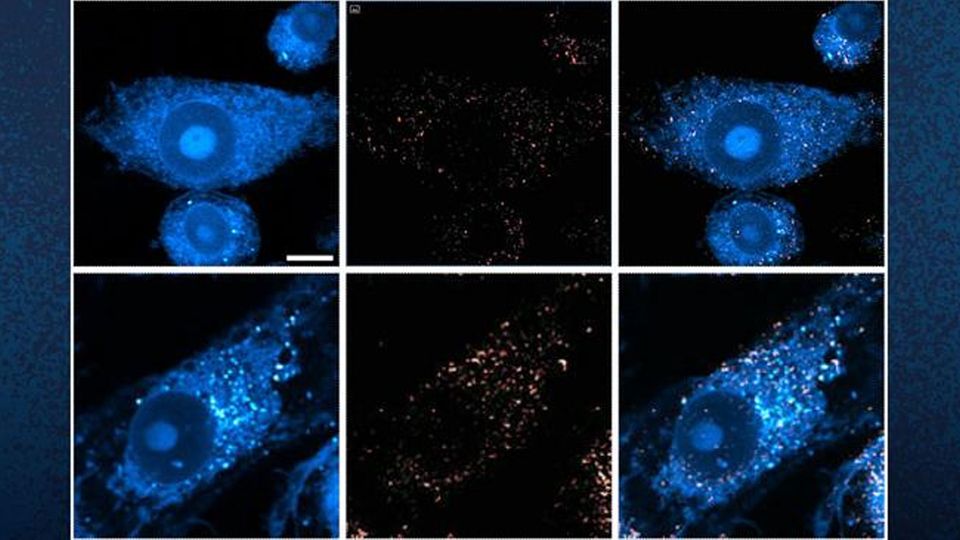 Six microscope images of brain cells, with lipid molecules shown in white.
