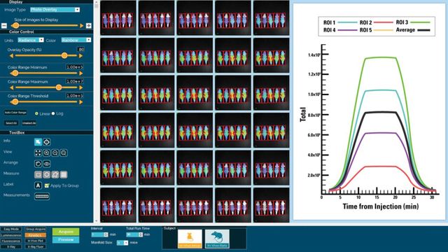 Results from an imaging test, showing a graph. 