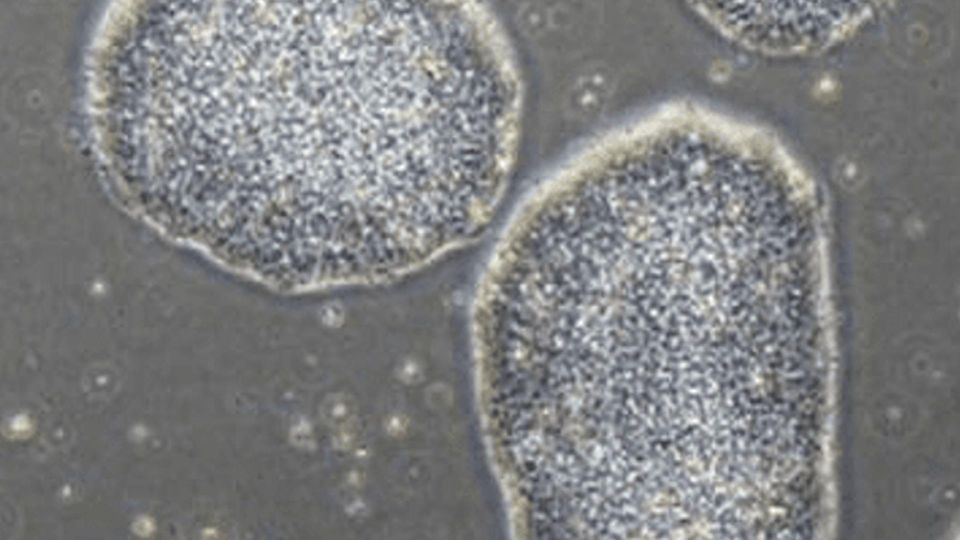Cells under a microscope.