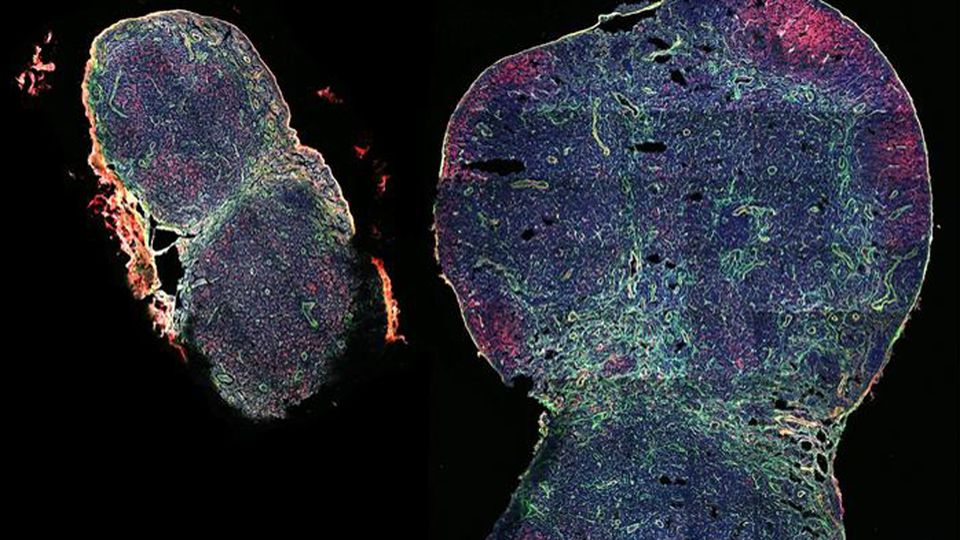 immunofluorescent staining shows a lymph node that has been significantly expanded in mice with the help of the biomaterial MPS-vaccine (on the right), next to a lymph node taken from non-treated control mice (on the left) at the same time post-vaccination.
