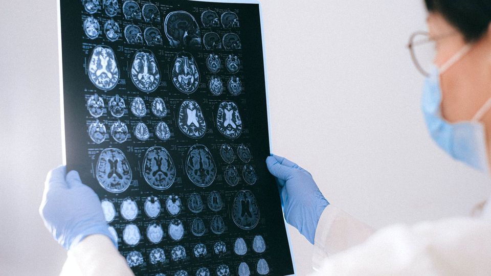 A clinician holds the results of a brain scan.