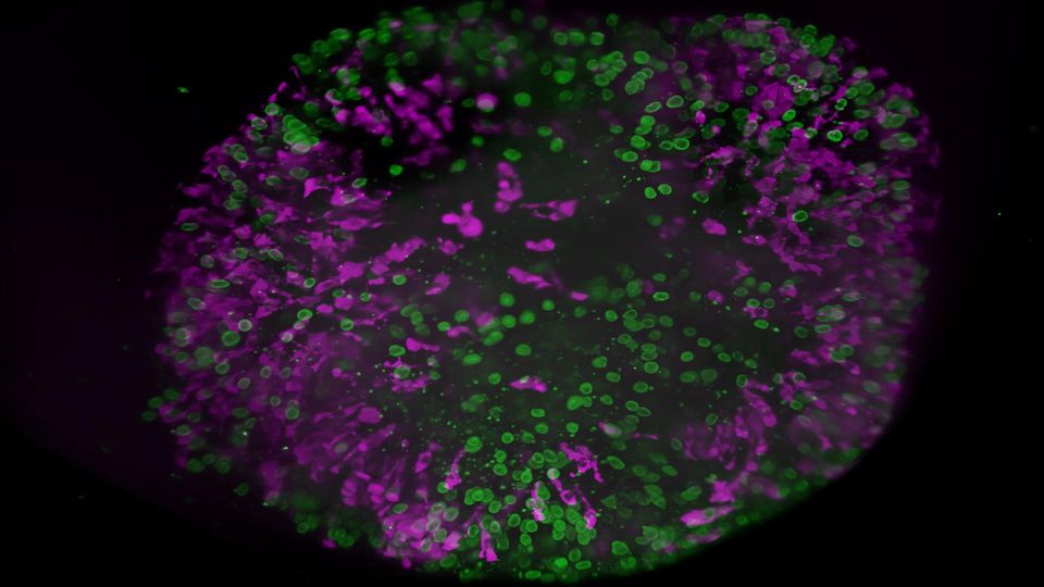 Brain organoids labeled with lamin (green) and tubulin (magenta).