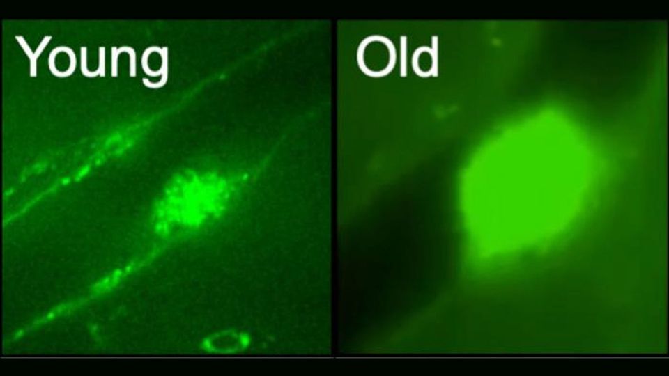 Two images of platelets, one a small clump in a young mouse, the other a large clump in an old mouse.