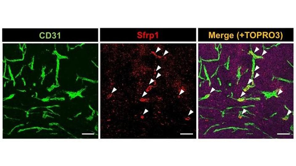 Microscopic imaging of blood vessels.