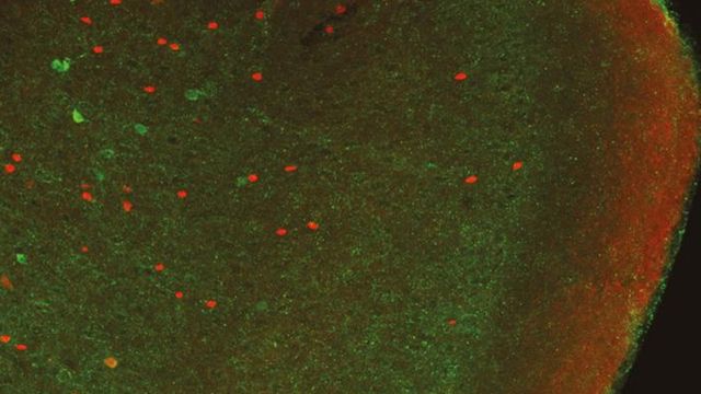 How Does The Brain Recognize Emotions Technology Networks