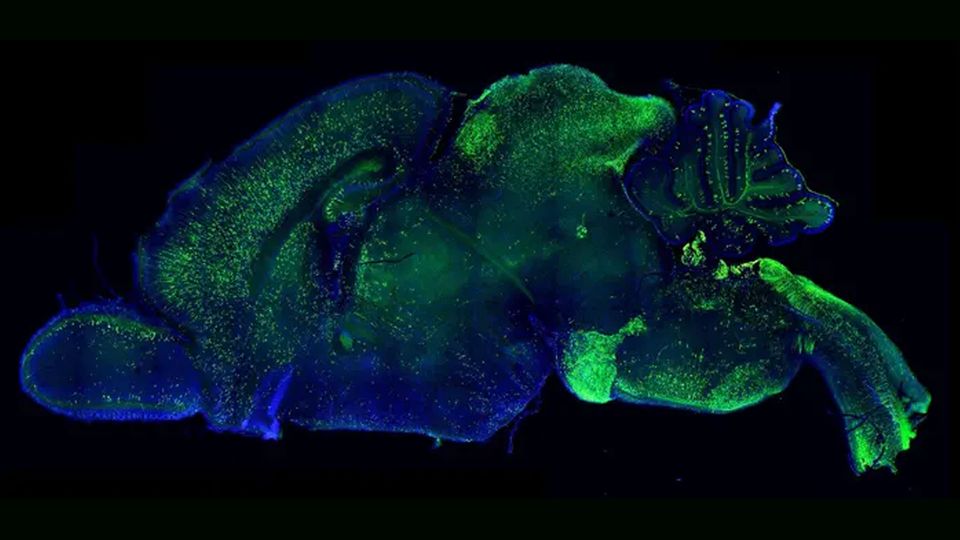 An outline of the brain, with different areas shown in green and dark blue.