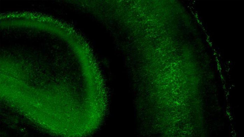 A cross-section of the somatosensory cortex in a young mouse brain. A key receptor protein named mGluR1 (green) is necessary to prime sensory circuits early in life, affecting how the mouse senses the world through touch.