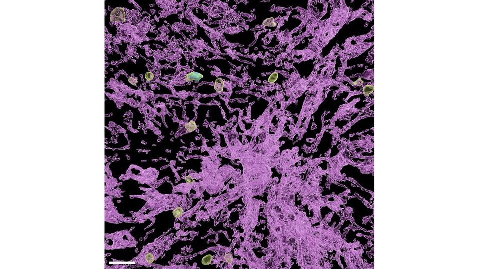 A virus-specific T cell in the vascular system of a liver with chronic hepatitis B virus infection.