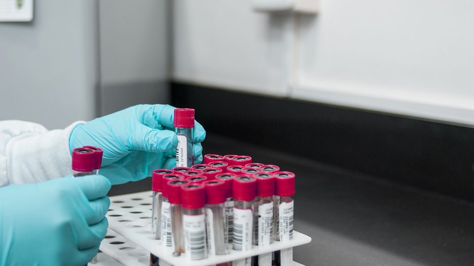A laboratory scientist handling test tubes containing blood samples