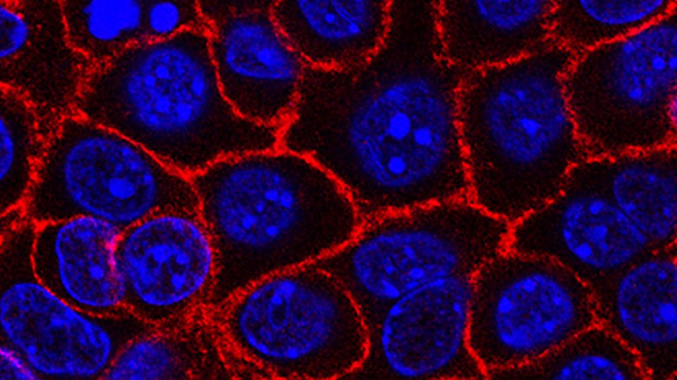 Pancreatic cancer cells (nuclei in blue) growing as a sphere encased in membranes (red).