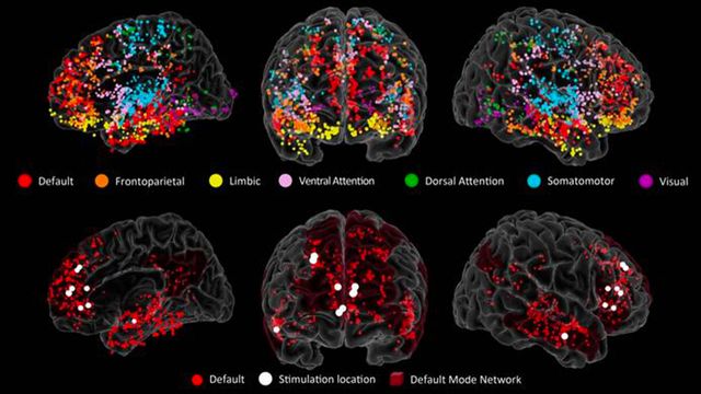 Study Pinpoints Origins of Creativity in the Brain | Technology