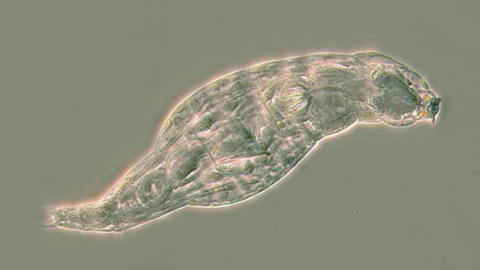 A Bdelloid rotifer under a microscope.