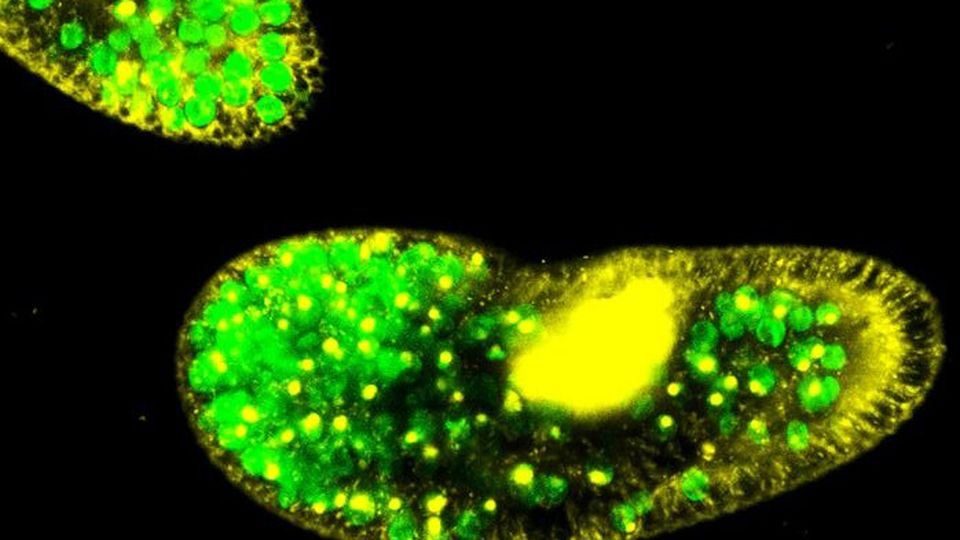 Fluorescence microscopy image of Paramecium bursaria showing Chlorella spp. algal symbionts in green.