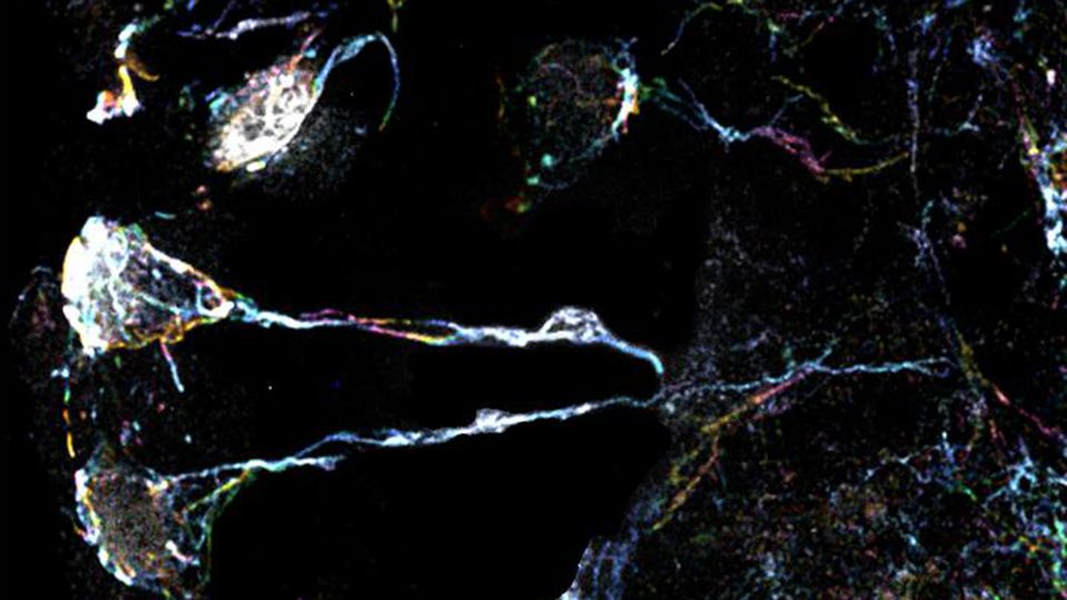 Dormant neural stem cells with protrusions rich in actin filaments in the Drosophila brain