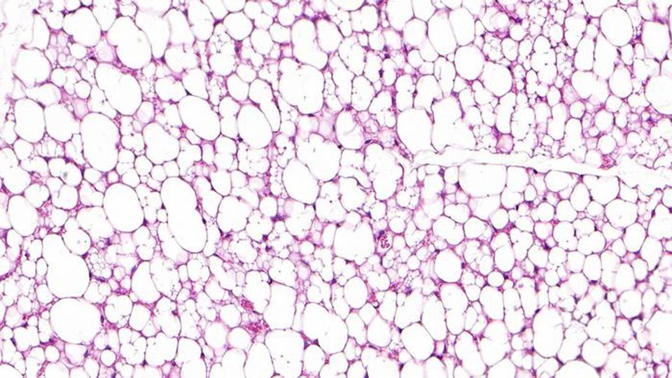 Adipose tissue of a mouse with white and beige fat cells.