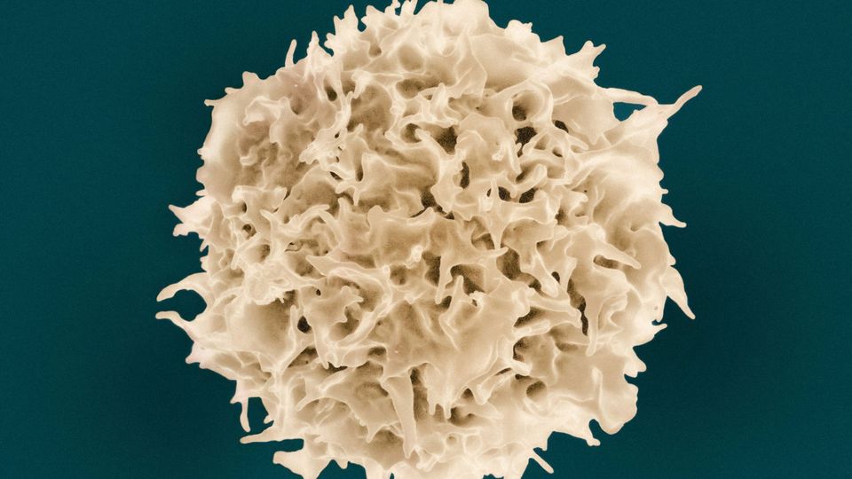 A scanning electron microscope image of a T lymphocyte.