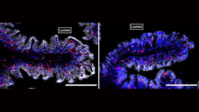 How Gut Microbiome Shapes Immune System Mapped in New Study ...