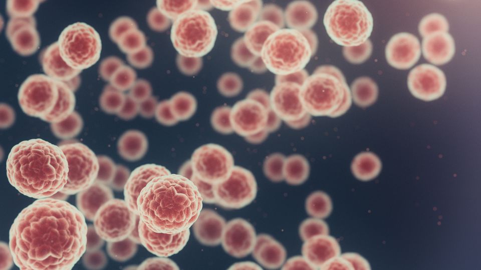 Cancer cells.