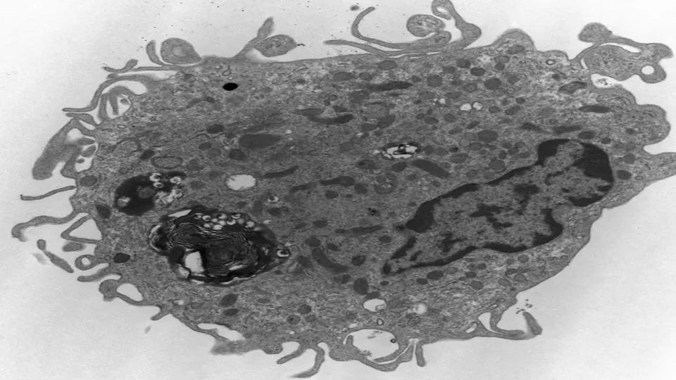 The human alveolar macrophage-like (AML) model contains many of the critical features of alveolar macrophages found in the lungs, including onion-shaped phagolysosomes (left) and the cell nucleus (right).