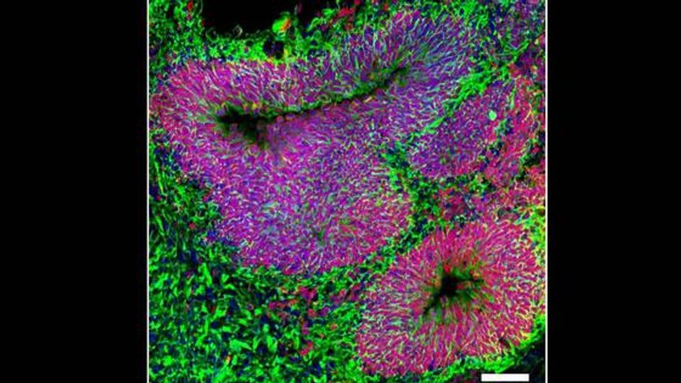 Mini-Brain Study Reveals Insights into Autism | Technology Networks