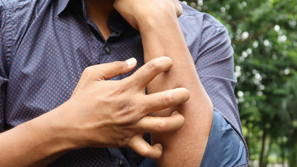 A person in a shirt itches their arm.