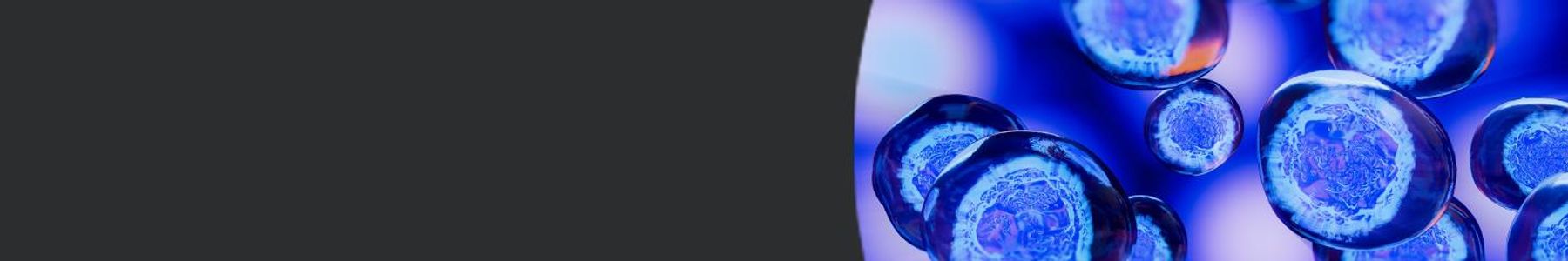 Evotec Webinar - December 4th 2024