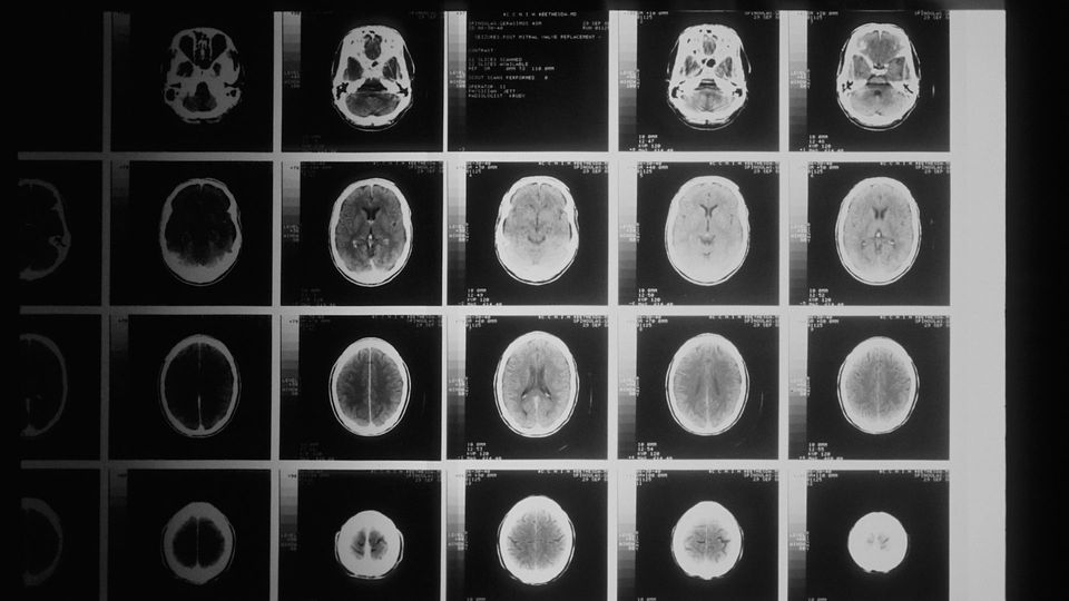 A brain scan.