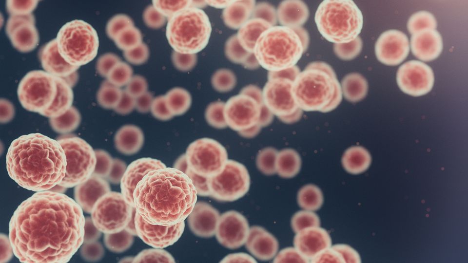 Cancer cells.