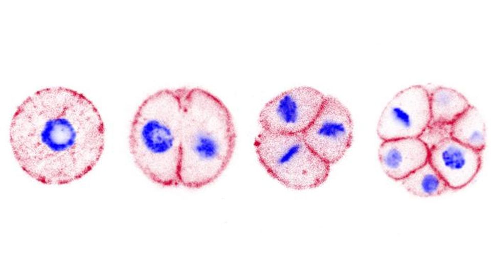 A microscope image of Chromosphaera perkinsii as it develops into a multicellular organism.